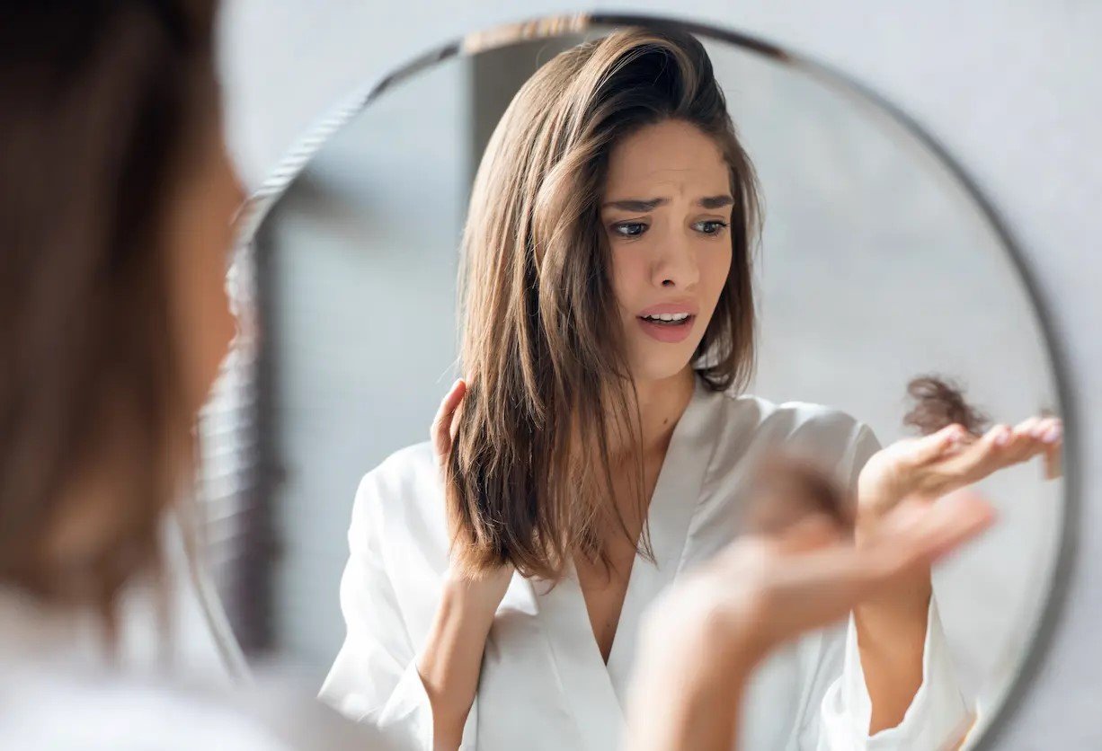 Alopecia En Mujeres